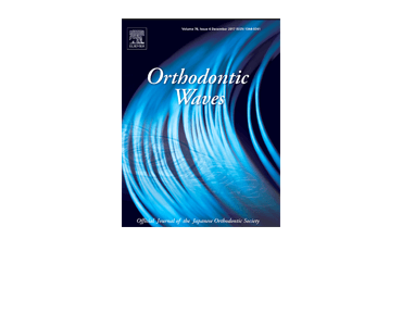 B_Orthodontic Waves